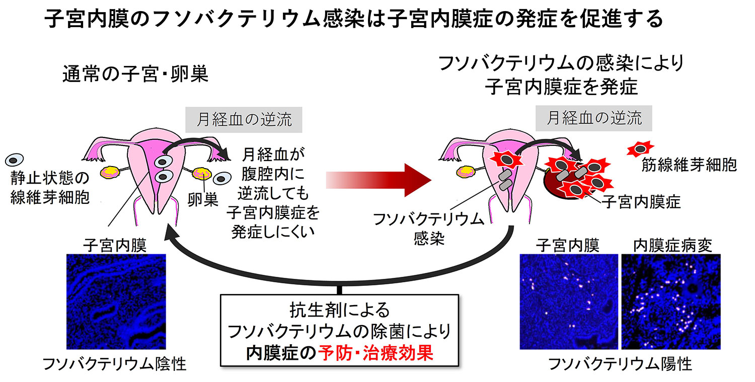 線維芽細胞によるがんの病態形成