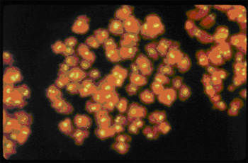 （画像）ヒト染色体を用いた間接蛍光抗体法