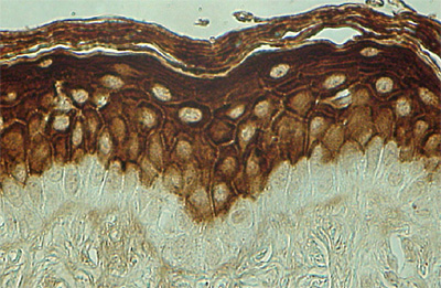 （画像）図説　正常表皮の免疫組織化学　Bip（UPRマーカー）