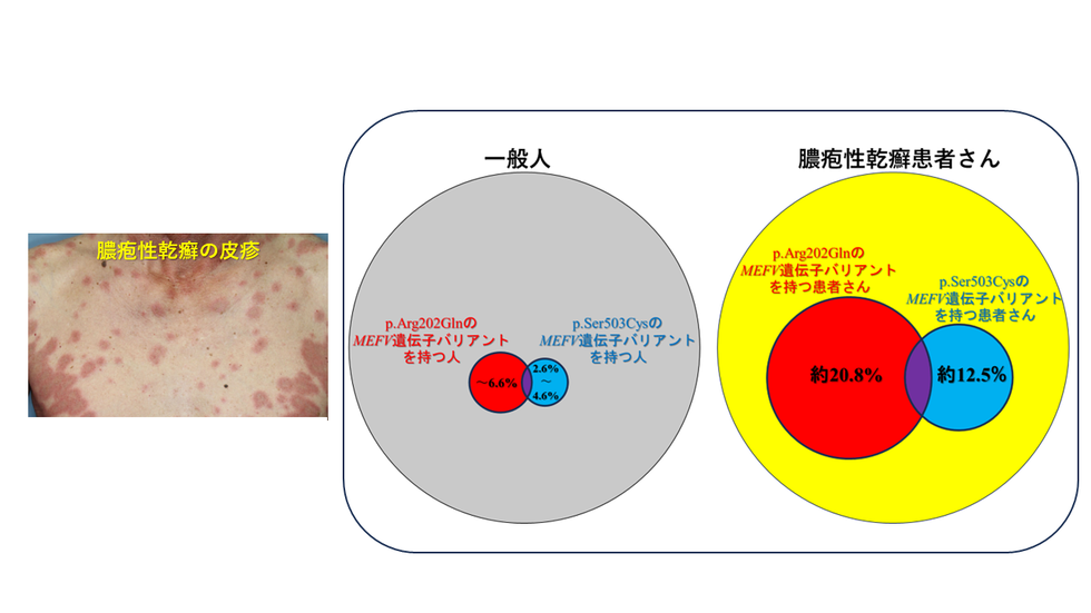 GPP / MEFV 研究成果ビジュアル