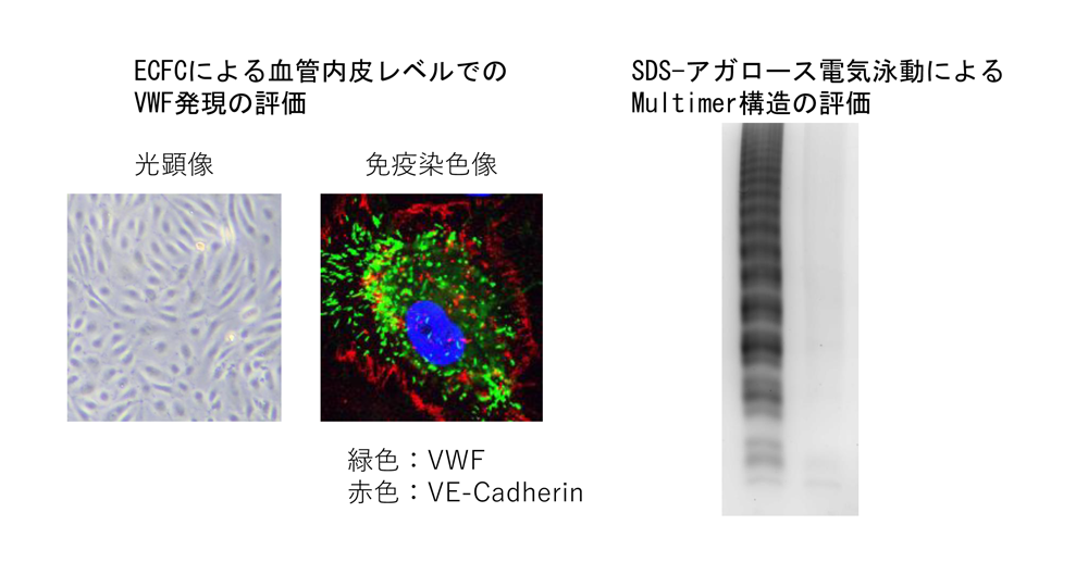 ECFCによる血管内皮レベルでのVWF発現の評価
