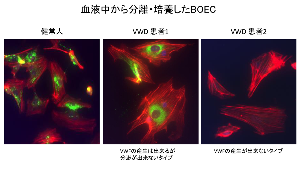 血栓 止血研究 研究について 名古屋大学大学院医学系研究科 血液 腫瘍内科学