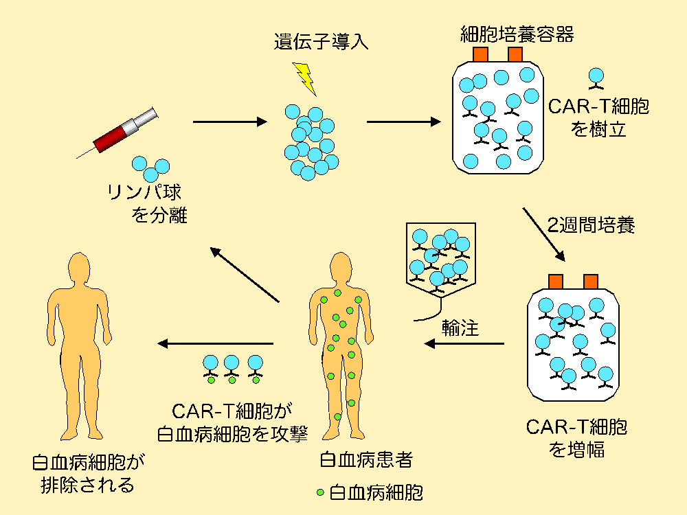 CAR-T_figure.png