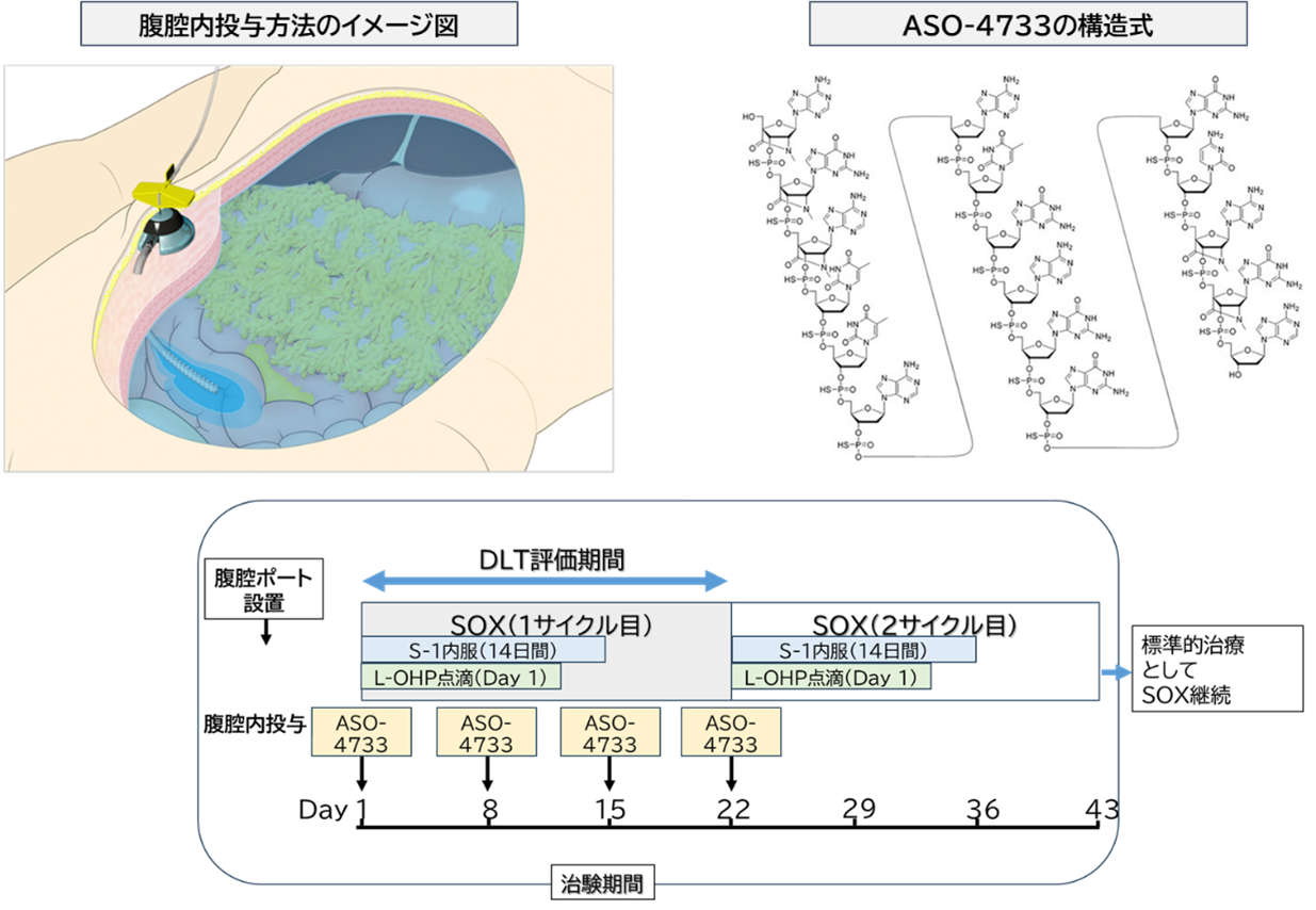 20250630_ASO-4733 治験開始_画像2.png