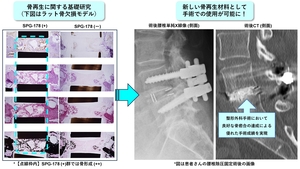 吸収性骨再生用材料「ヴァーテ」医療機器承認取得のお知らせ