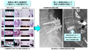 吸収性骨再生用材料「ヴァーテ」医療機器承認取得のお知らせ