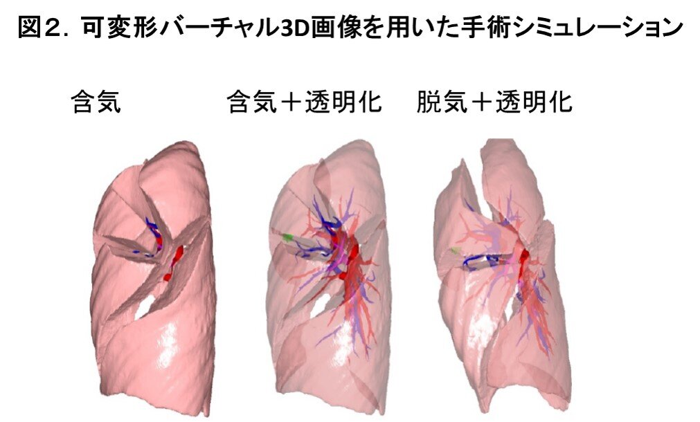 2022年1月_研究アップデート_図2.jpg