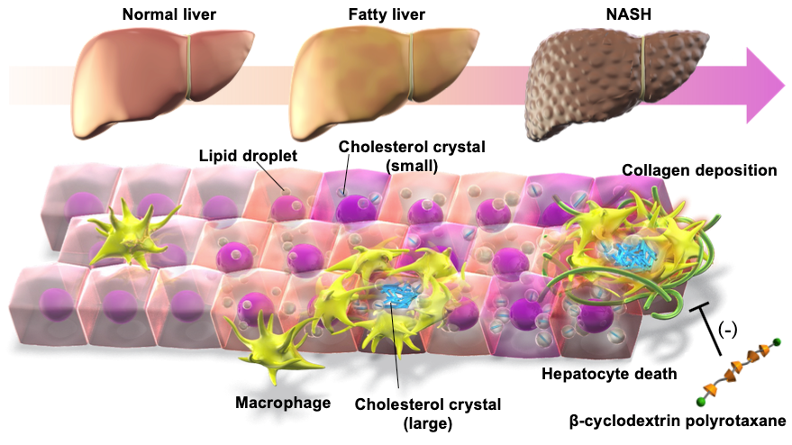 Lysosomal cholesterol overload in macrophages promotes liver fibrosis in a mouse model of NASH