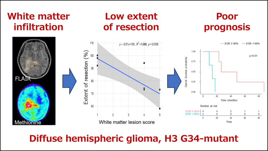 Imaging Features and Consideration of Progression Pattern of Diffuse Hemispheric Gliomas, H3 G34-mutant