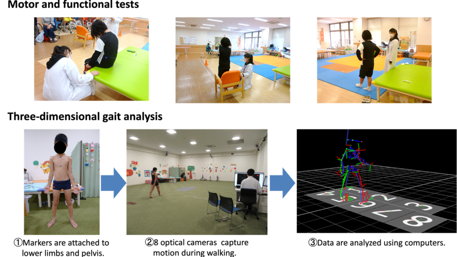 Investigating the Motor Function of School-Age Children Born with Congenital Diaphragmatic Hernia: The Need for Long-Term Efforts to Improve Motor Function.