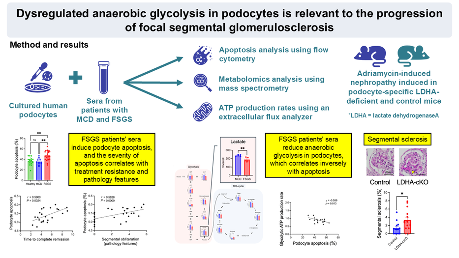 Energy Metabolism Breakdown in Podocytes Identified as Key Driver of FSGS Progression