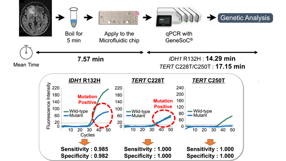 Ultra-Rapid Intraoperative Genetic Diagnosis of Brain Tumors Achieved in Just 25 Minutes - A Breakthrough in Real-Time Brain Tumor Diagnosis During Surgery -