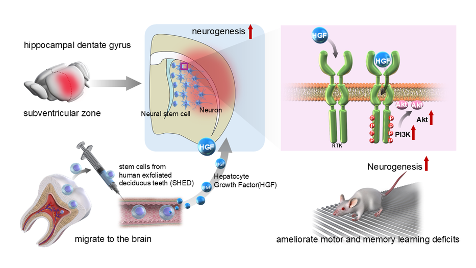Evaluation of the Therapeutic Efficacy of Intravenous Administration of Human Stem Cells from Exfoliated Deciduous Teeth (SHED) in the Chronic Phase of Cerebral Palsy ―A New Hope for Chronic Brain Injury Long Considered Difficult to Treat--