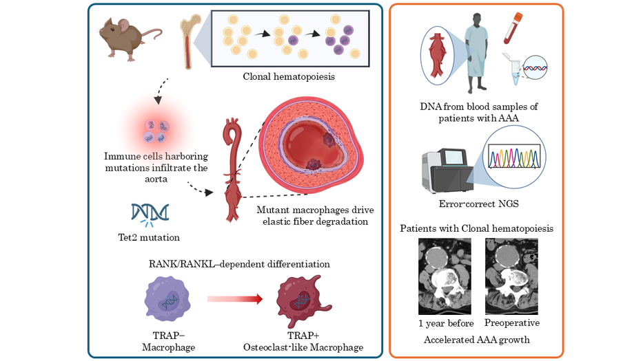 Tet2-driven Clonal hematopoiesis drives aortic aneurysm via macrophage-to-osteoclast-like differentiation