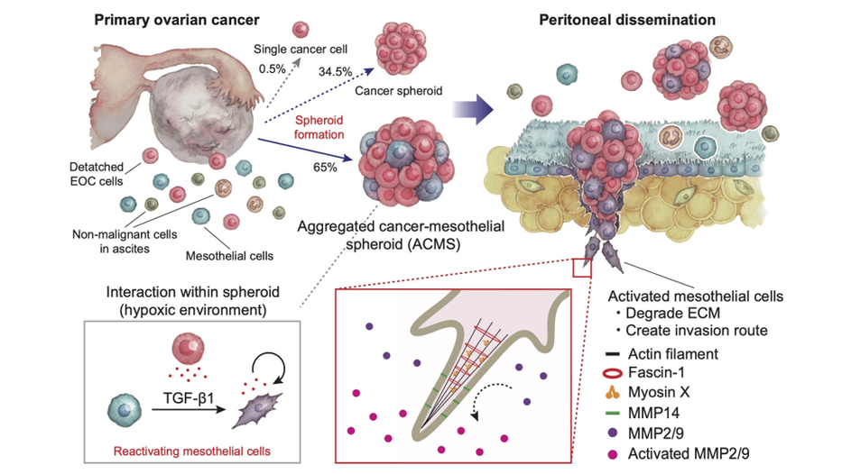Mesothelial cells promote peritoneal invasion and metastasis of ascites-derived ovarian cancer cells through spheroid formation