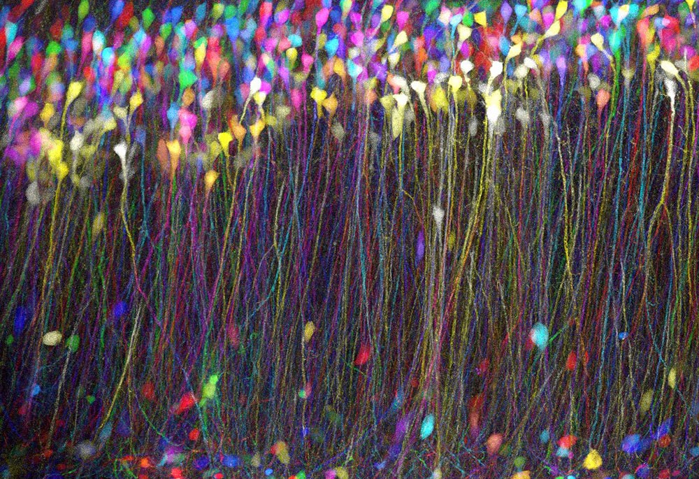 研究成果物 ラット海馬CA1錐体細胞層