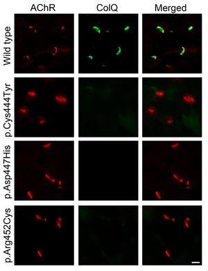 Fig03_COLQ_mutants.jpg