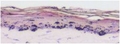 Fig2liverspot.jpg