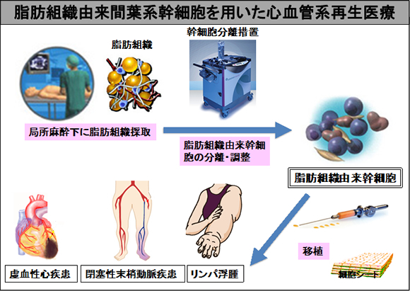 脂肪組織由来間葉系幹細胞を用いた心血管系再生医療