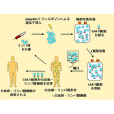 名古屋大学とタイ王国チュラロンコン大学と連携　～非ウイルスベクター法CAR-T細胞によって治療抵抗性悪性リンパ腫の治療に成果～