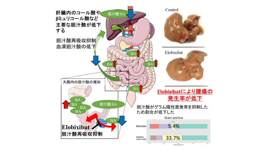 非アルコール性脂肪性肝炎モデルマウスにおける胆汁酸トランスポーター阻害薬（エロビキシバット）による肝腫瘍発生抑制効果の発見