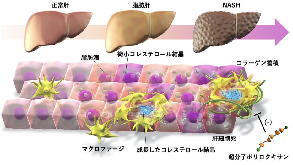 マクロファージへのコレステロール蓄積が肝線維化を促進する： 超分子ポリロタキサンを用いた非アルコール性脂肪肝炎治療法の開発へ