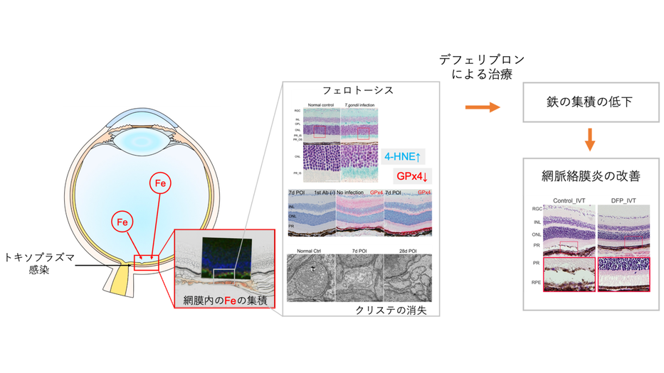 眼トキソプラズマ症の病態に 鉄を伴う細胞死であるフェロトーシスが関与していることを発見 〜眼トキソプラズマ症の新規診断方法と治療法の確立へ〜