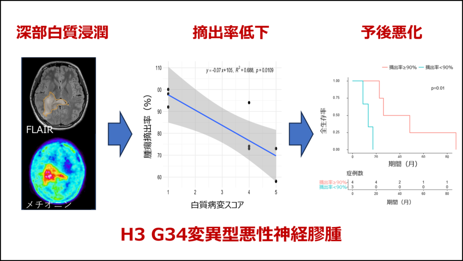 小児・若年者に多い新規脳腫瘍の進行様式を報告！～深部病変の腫瘍摘出率と予後への影響～