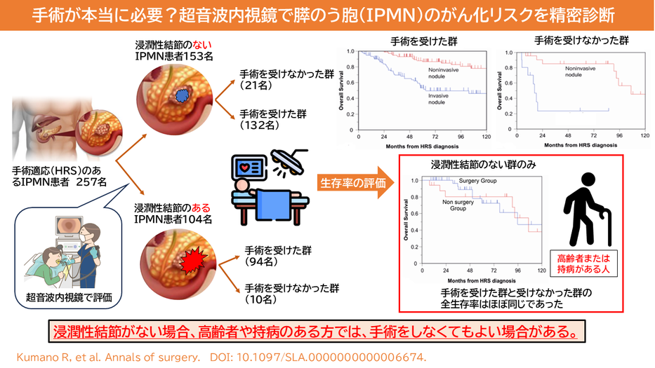 手術が本当に必要？ 超音波内視鏡で膵のう胞（IPMN）のがん化リスクを精密診断