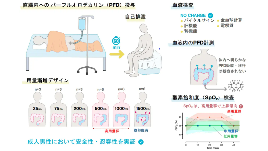 「お尻から呼吸する」腸換気法の安全性をヒトで実証 －重症呼吸不全患者への臨床応用に向けて大きく前進－