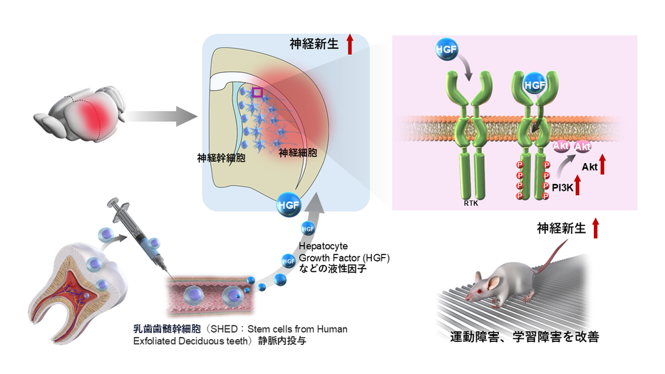 脳性麻痺慢性期に対する ヒト乳歯歯髄幹細胞（SHED）の静脈内投与の治療有効性評価 ～治療が困難とされてきた慢性期脳障害に新たな希望を～