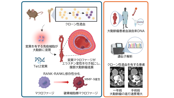 新たな視点：加齢に伴う血液の変化「クローン性造血」 が大動脈瘤を悪化させる仕組みを解明 ～免疫細胞に着目した治療戦略の可能性～