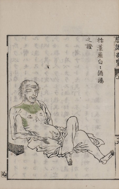 1801-1809 稲葉克文礼 『腹證奇覧』(1)