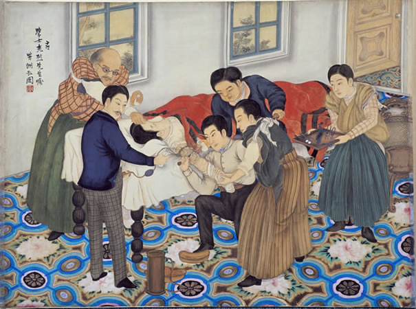 Illustration of a Surgical Operation at Aichi Prefectural Public Hospital in the Early Years of the Meiji Period (approx. Meiji 13 (1880)) Image1