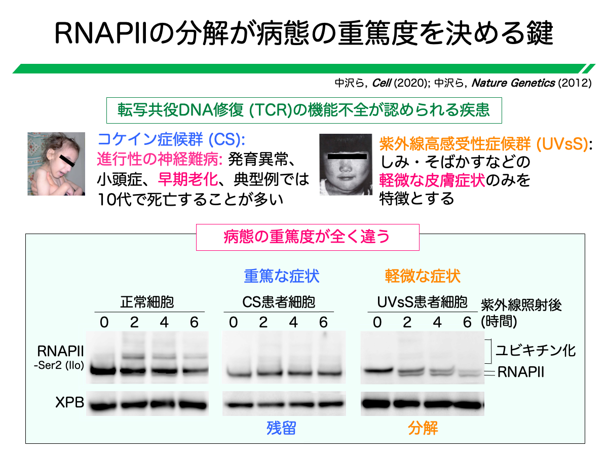 RNAPIIの分解が病態の重篤度を決める鍵
