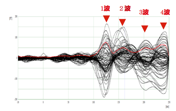 健常高齢者の記録例と刺激後 250 ms まで同定される VEF 成分