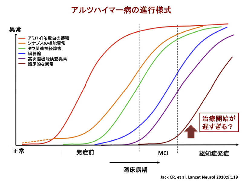 脳とこころの病気について 名古屋大学 脳とこころの研究センター