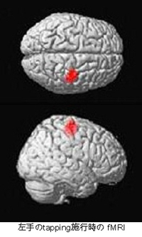 fMRI