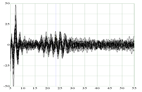 SEFの高周波振動（HFOs、記録周波数帯域：400～600Hz）