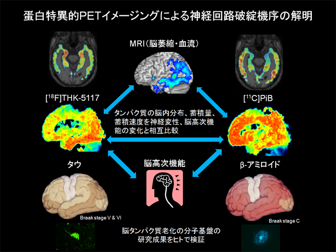 蛋白特異的PETイメージングによる神経回路破綻機序の解明