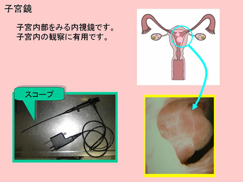 不妊治療に関する情報