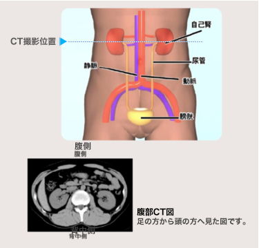 CT撮影位置